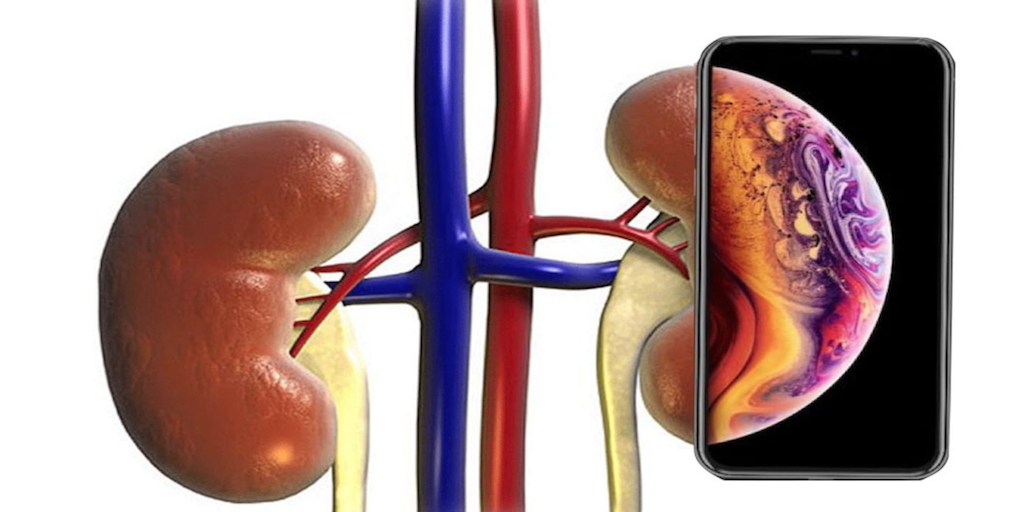 iphone X kidney